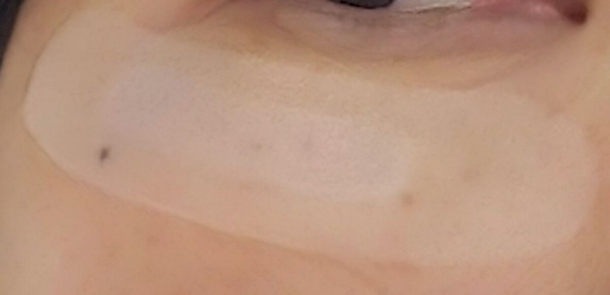 ヒアロディープパッチ/北の快適工房/シートマスク・パックを使ったクチコミ（2枚目）