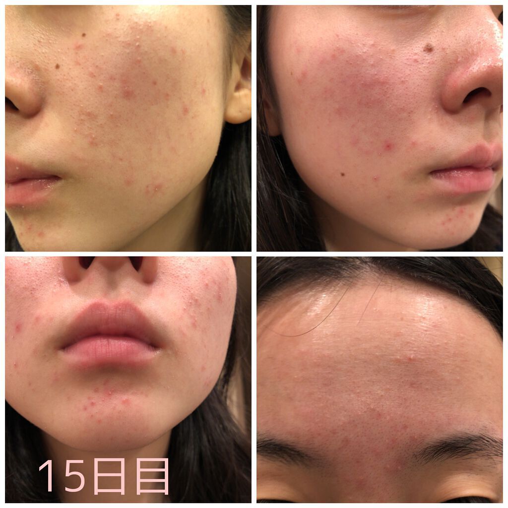 プロP ミスト/CNP Laboratory/ミスト状化粧水を使ったクチコミ（3枚目）