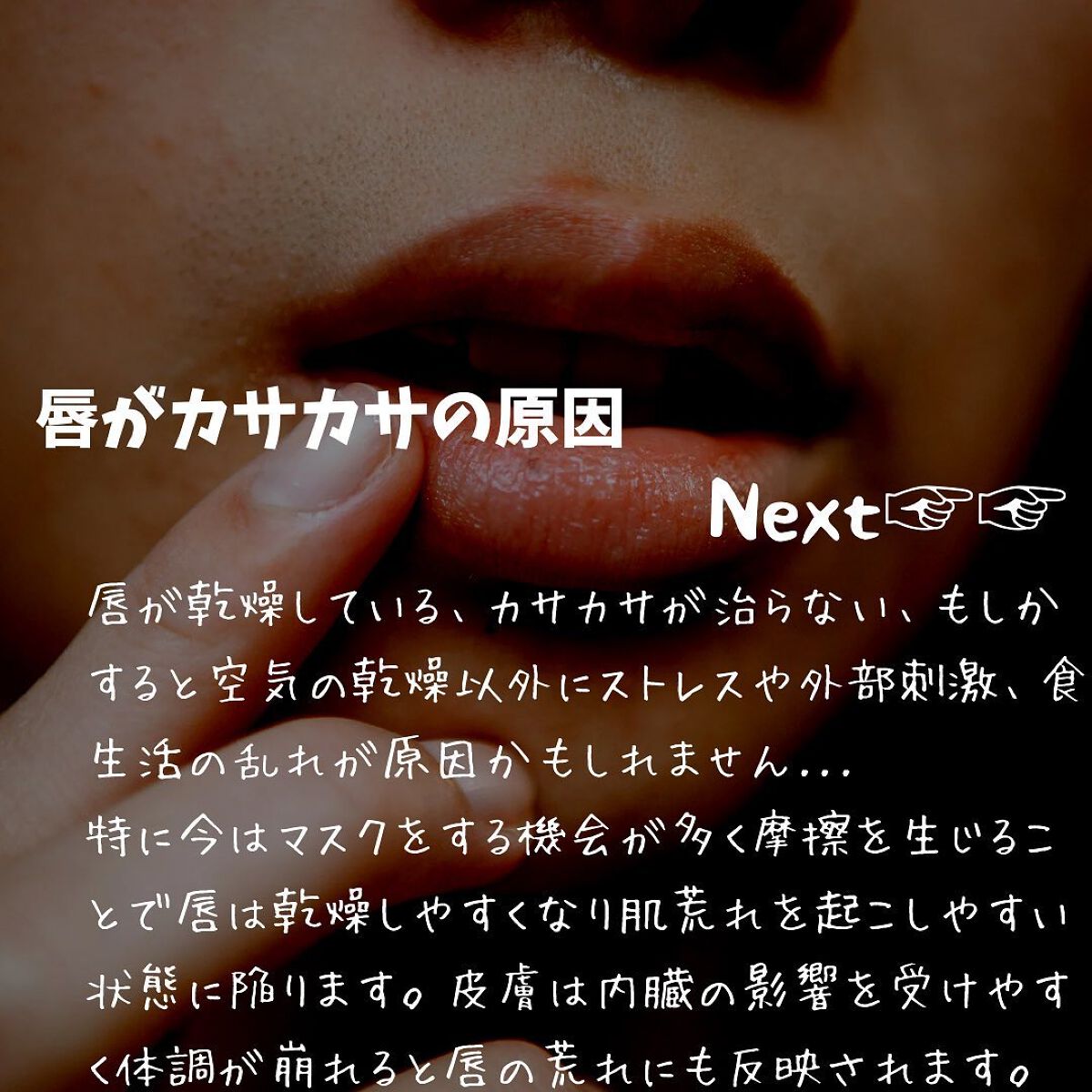 けんけん/健康美容で垢抜け🍀 on LIPS 「唇カサカサの人集合〜!唇が荒れると恥ずかしいですし何より地味に..」(4枚目)