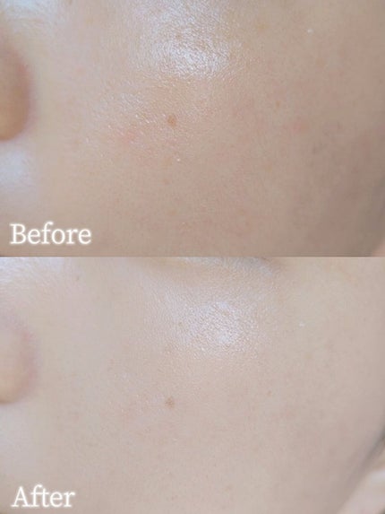 フェイス ブラー フィニッシング パウダー/Dear.A/ルースパウダーを使ったクチコミ(4枚目)