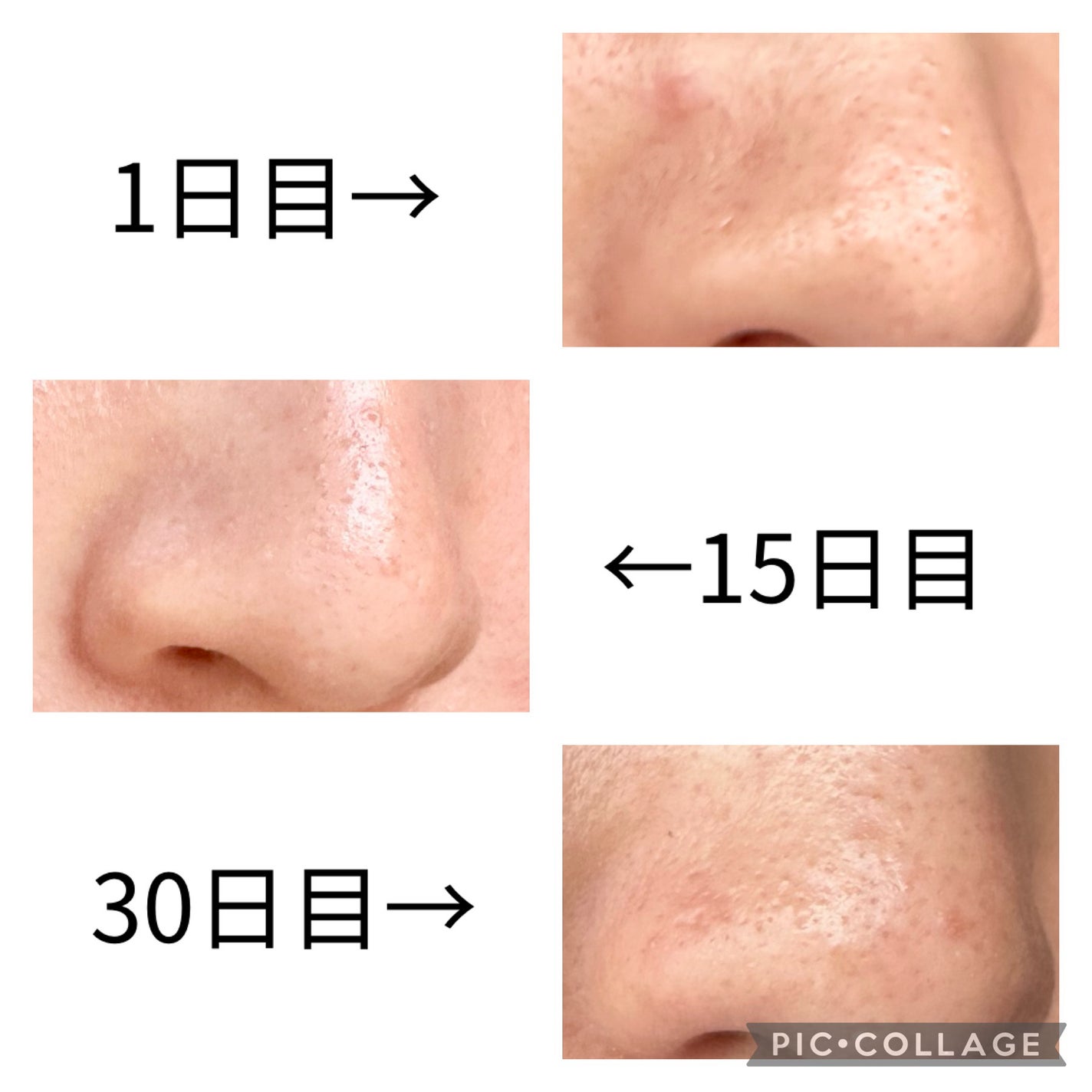 ミシャ ビタシープラス デイリーマスク【日本処方】/MISSHA/シートマスク・パックを使ったクチコミ(8枚目)