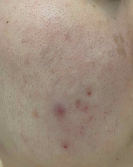 Cセラム/b.glen/美容液を使ったクチコミ(2枚目)