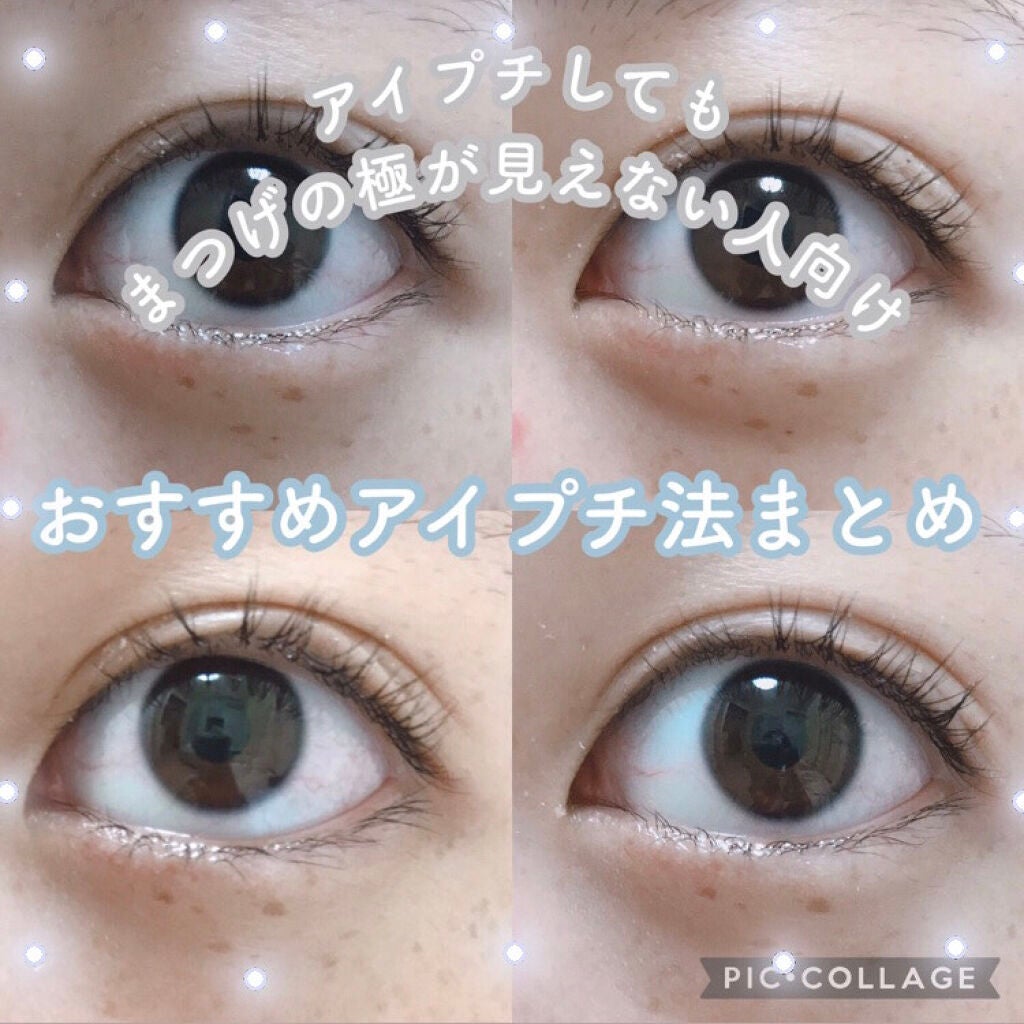 肌色タイプ/バンドエイド/その他を使ったクチコミ(1枚目)