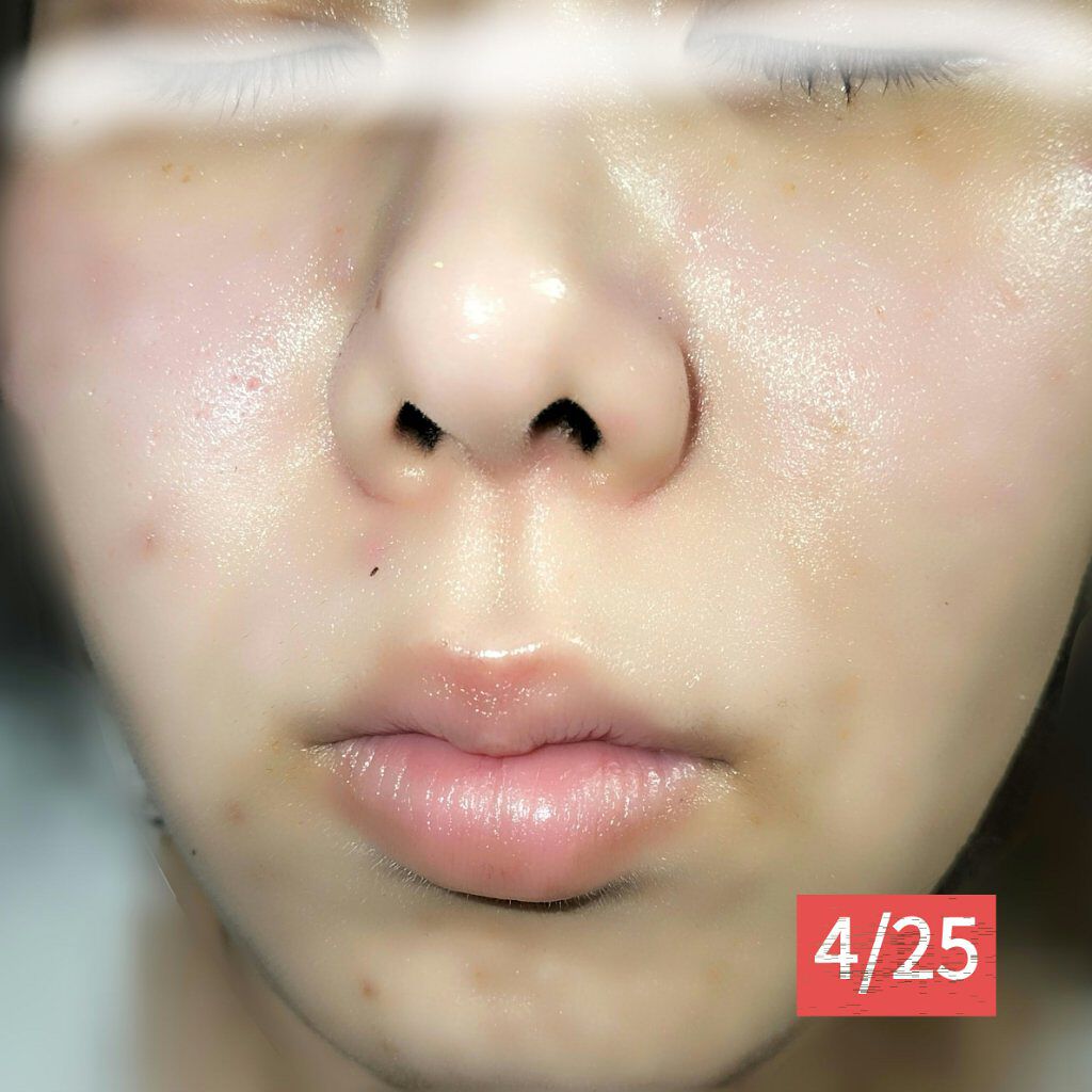 ピュア　ナチュラル　エッセンスローション　リフト　/pdc/オールインワン化粧品を使ったクチコミ（3枚目）