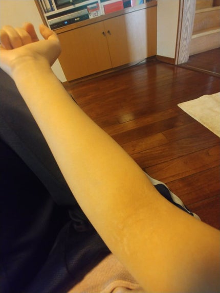 é§æµªð on LIPS ãåæçš¿ã§ããç§ãšåããã¢ãããŒã«æ©ãã§ãã人ã®ãããã§ãå©ãã«..ãïŒ1æç®ïŒ