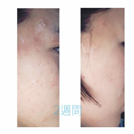 ハトムギ化粧水(ナチュリエ スキンコンディショナー R )/ナチュリエ/化粧水を使ったクチコミ(4枚目)