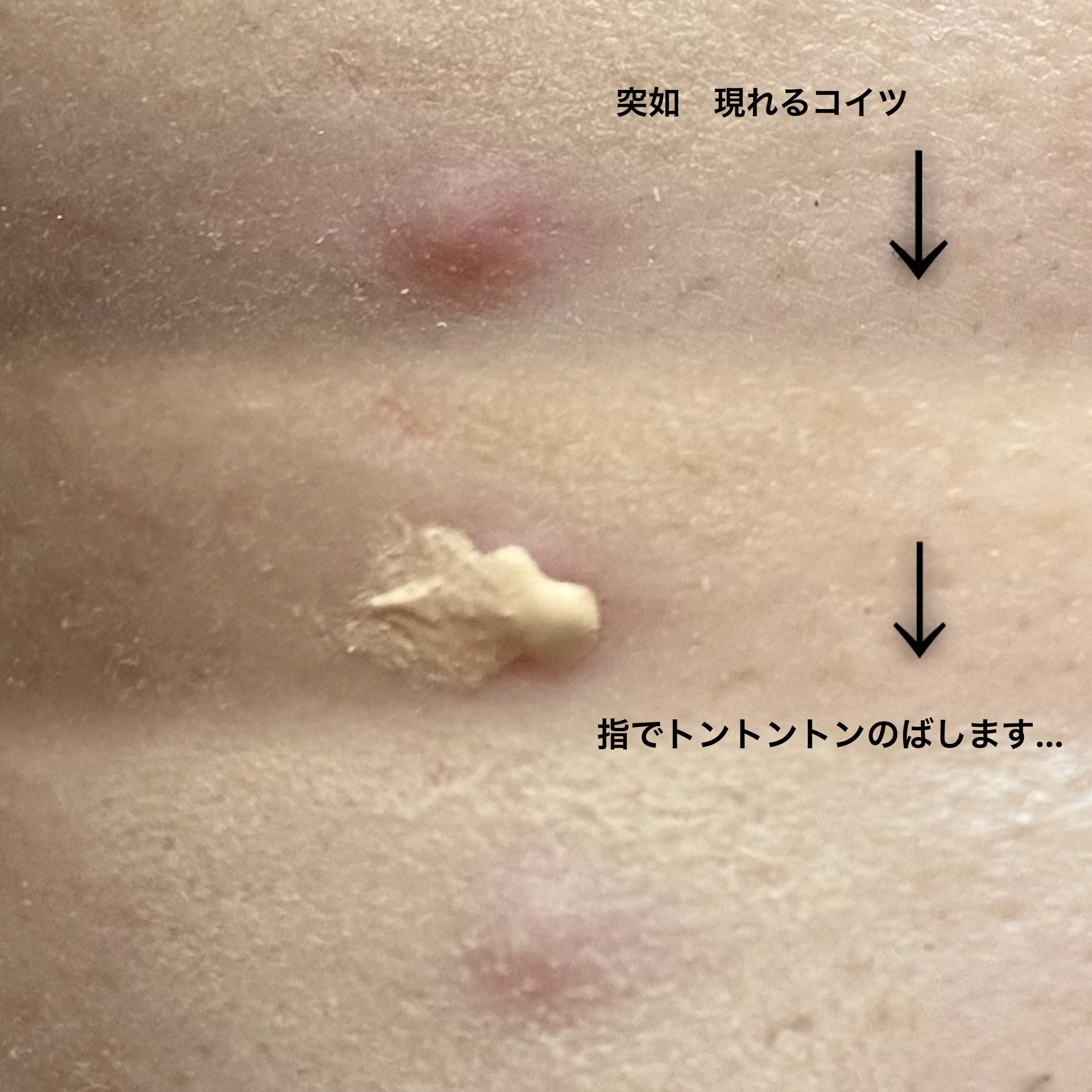 イプノス シーバムクリア リペアクリーム/ACSEINE/フェイスクリームを使ったクチコミ（3枚目）