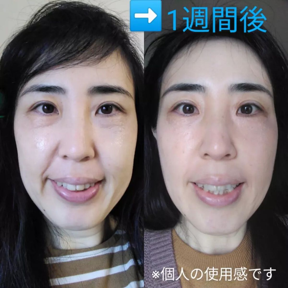 ORGANIC スキンケアローション/ADone/化粧水を使ったクチコミ（2枚目）