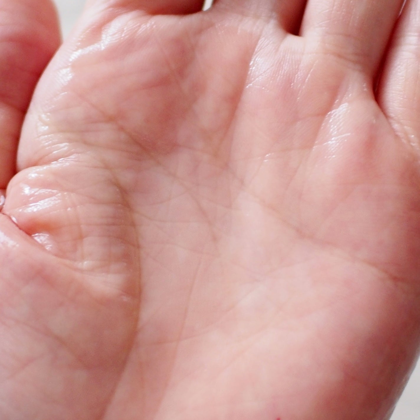 タカミスキンピール/タカミ/ブースター・導入液を使ったクチコミ(4枚目)