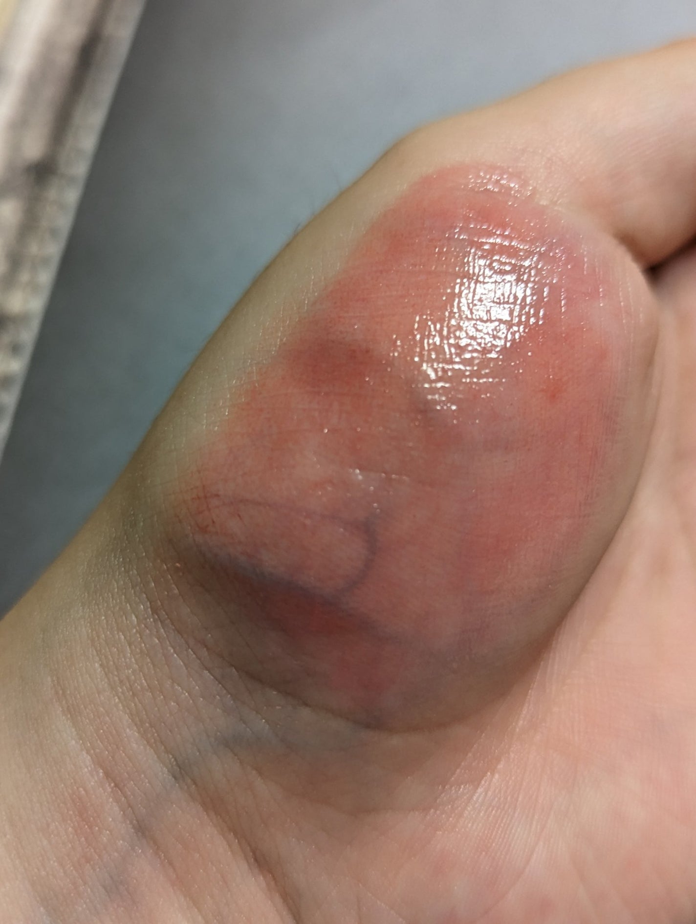 フルーティーリップジャム/dasique/リップバームを使ったクチコミ(5枚目)