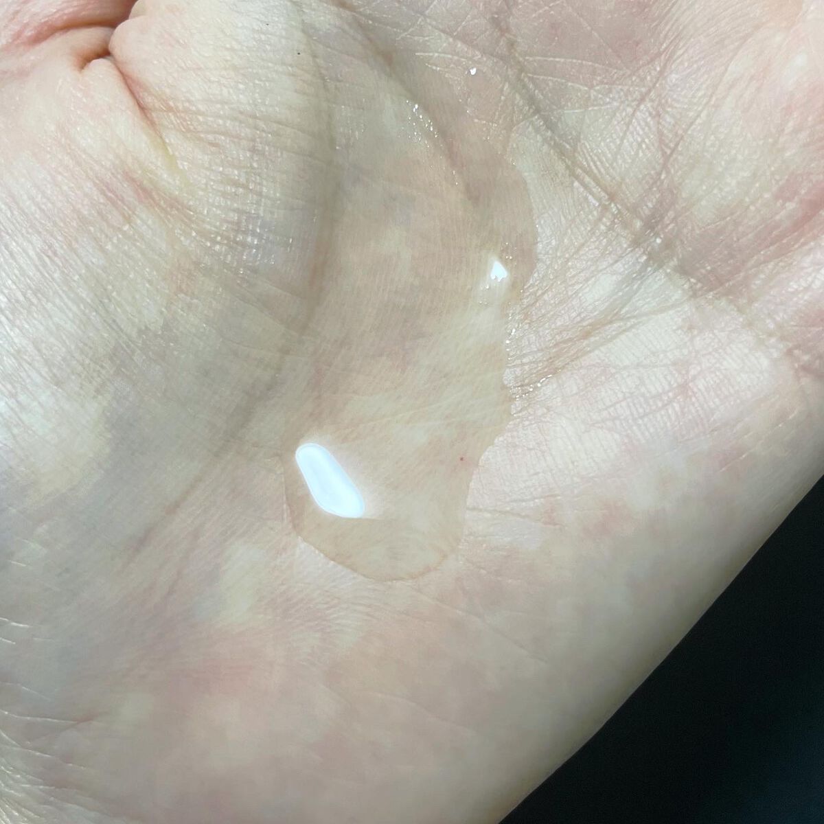 マジックティーツリーオイル/ブラン/フェイスオイルを使ったクチコミ（2枚目）