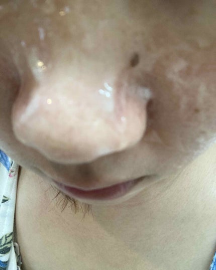 ドクターメディオン スパオキシデュアルジェル/ドクターメディオン/洗い流すパック・マスクを使ったクチコミ(2枚目)