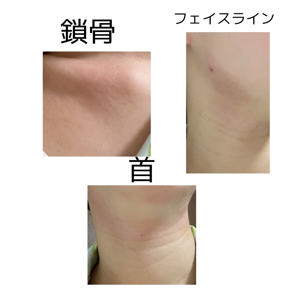 CICAフェイス&ボディクリーム/サイムダン プレミアム/フェイスクリームを使ったクチコミ(3枚目)