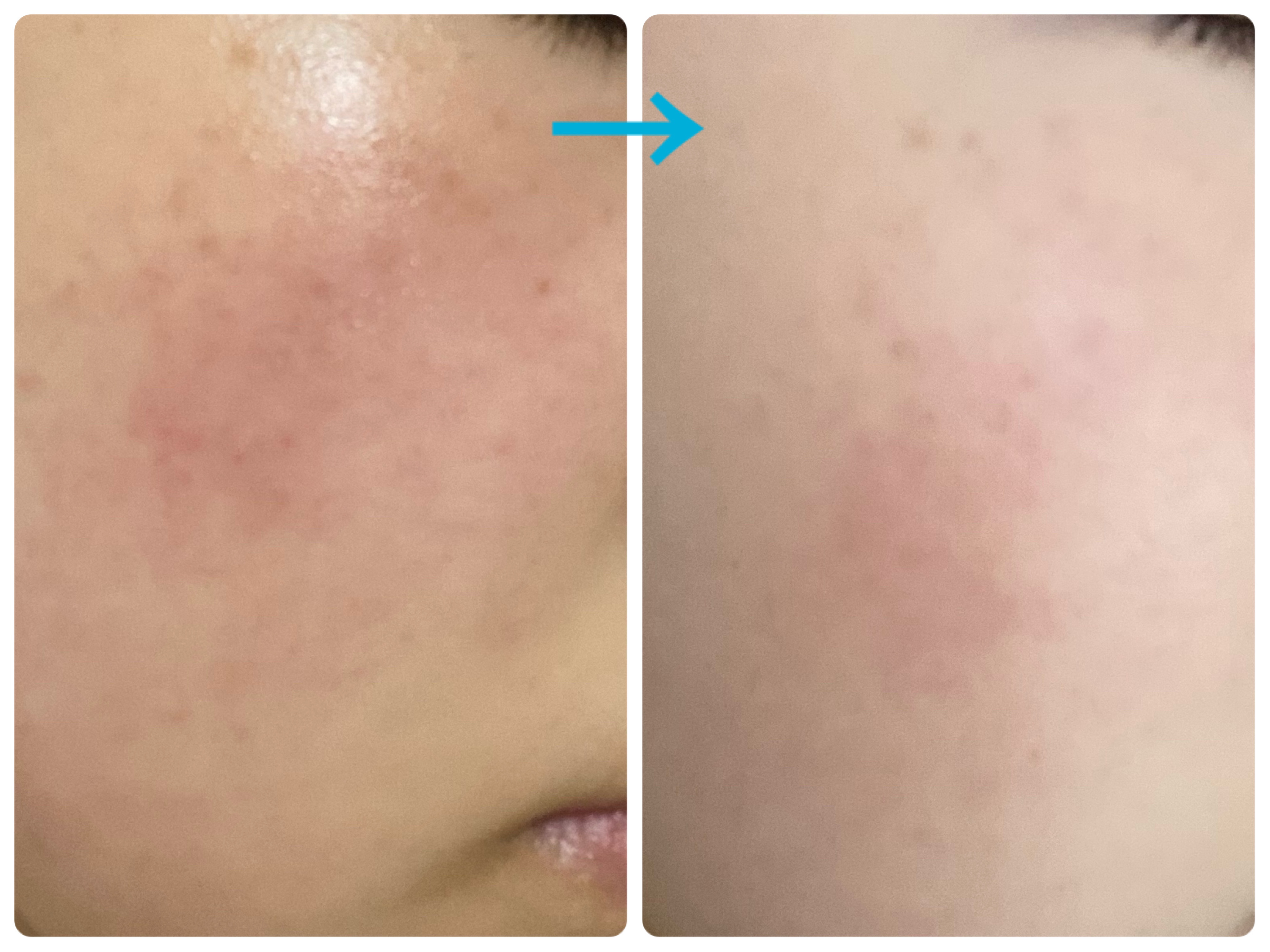 薬用フェイスプロテクトパウダー/IHADA/プレストパウダーを使ったクチコミ（3枚目）