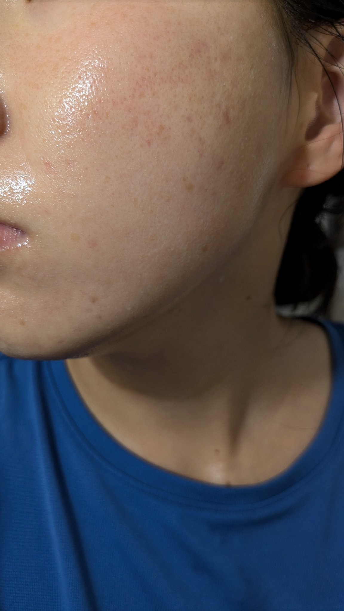 A2+NAG2ソリューション/The Ordinary/美容液を使ったクチコミ（2枚目）