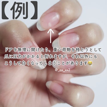 Dr.Nail デイケアオイルのクチコミ「自爪をここまで伸ばした方法♡どちらも左手です！



【おすすめのケア商品】

◆Dr.Nai.....」（3枚目）