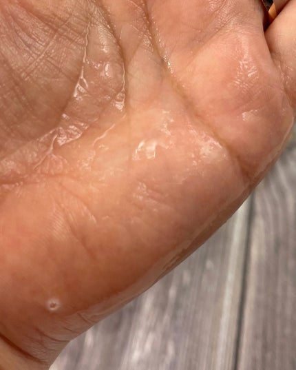 ハーバルケアローション/シュラメック/化粧水を使ったクチコミ(4枚目)