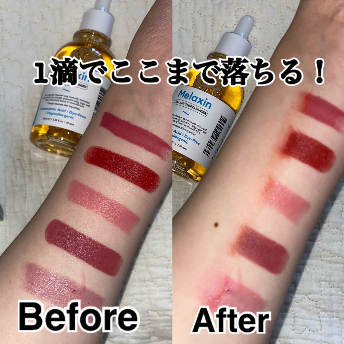 TX-アンプルクレンザー/Dr.Melaxin/美容液を使ったクチコミ(3枚目)