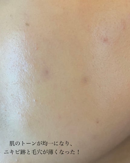 RMK ラスティング ジェルクリーミィファンデーション/RMK/クリーム・エマルジョンファンデーションを使ったクチコミ(3枚目)