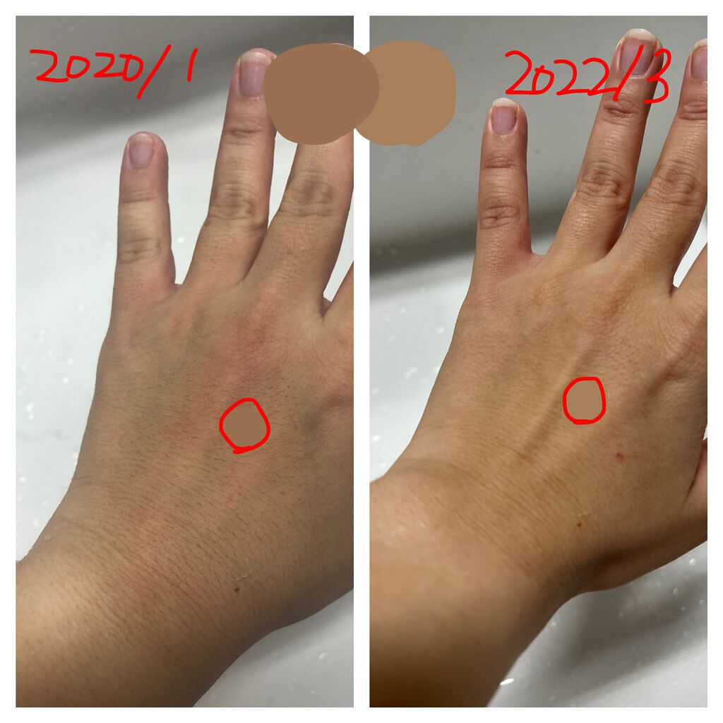 キュアティ ホワイト プレミアム(医薬品)/S SELECT/その他を使ったクチコミ（2枚目）