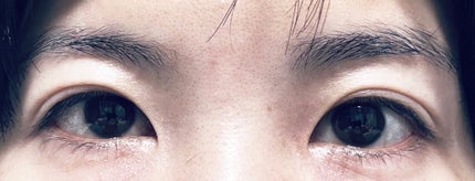 群青 on LIPS 「アイメイクが難しいと思う私の目の特徴。すっぴん目元の画像注意。..」(2枚目)