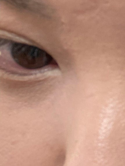 【旧】ディオールスキン フォーエヴァー スキン コレクト コンシーラー/Dior/リキッドコンシーラーを使ったクチコミ(3枚目)