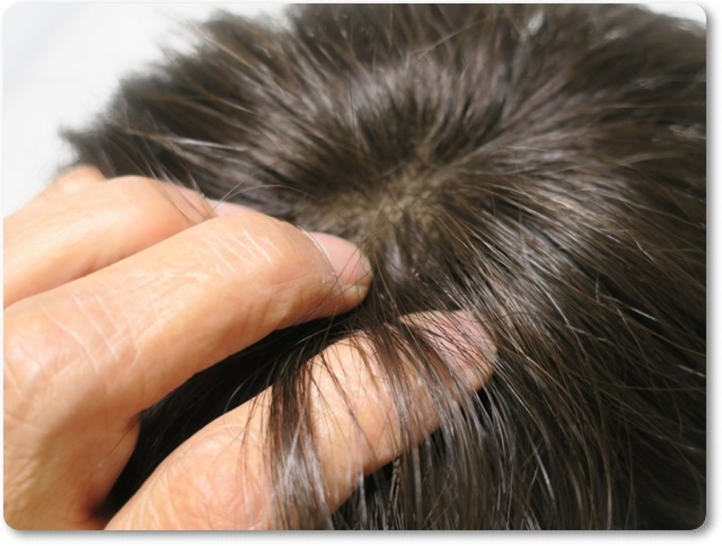 穂乃髪/エポラ/頭皮ローションを使ったクチコミ（3枚目）