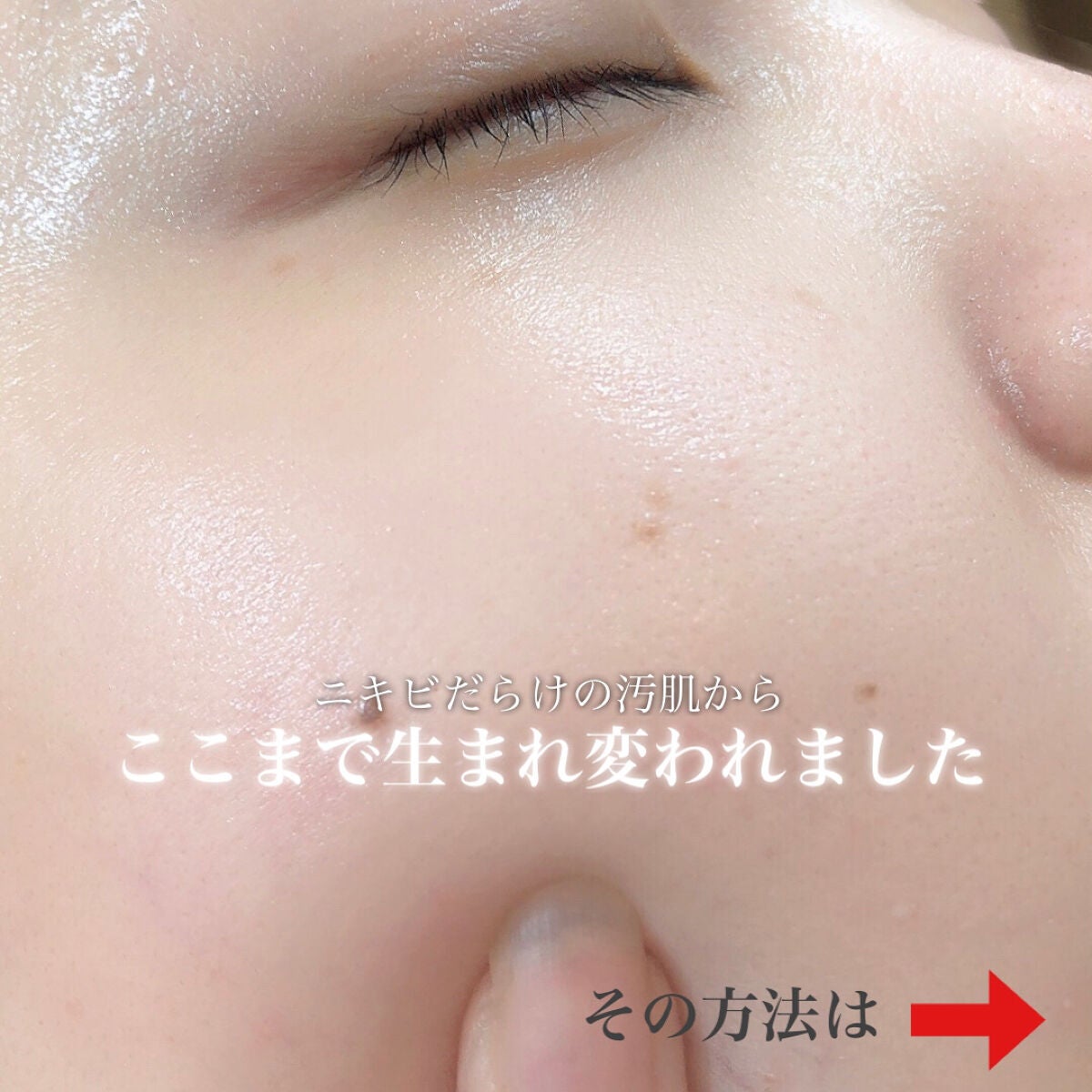 ジョンソン ベビーオイル 無香料/ジョンソンベビー/ボディオイルを使ったクチコミ(2枚目)