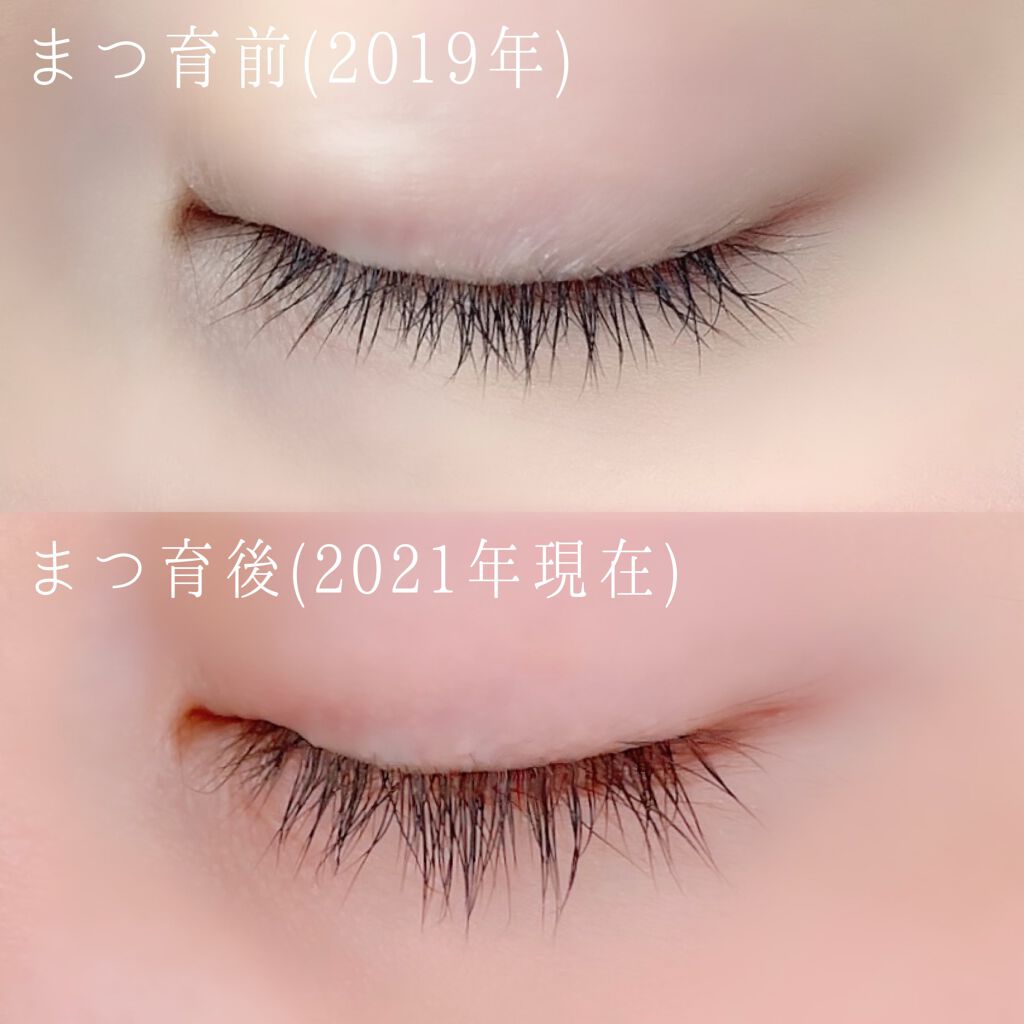 エグータム/アルマダスタイル/まつげ美容液を使ったクチコミ(3枚目)