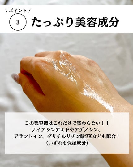 ゆりか│ニキビ肌向けスキンケア解説 on LIPS 「@yurika_nikibi.care👉ニキビ撲滅したい人保存..」(6枚目)