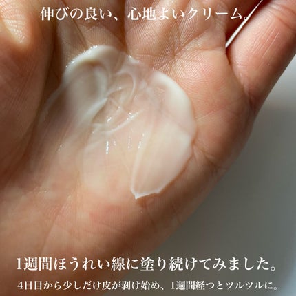 レチノール0.1%クリーム/Frankly/フェイスクリームを使ったクチコミ(5枚目)