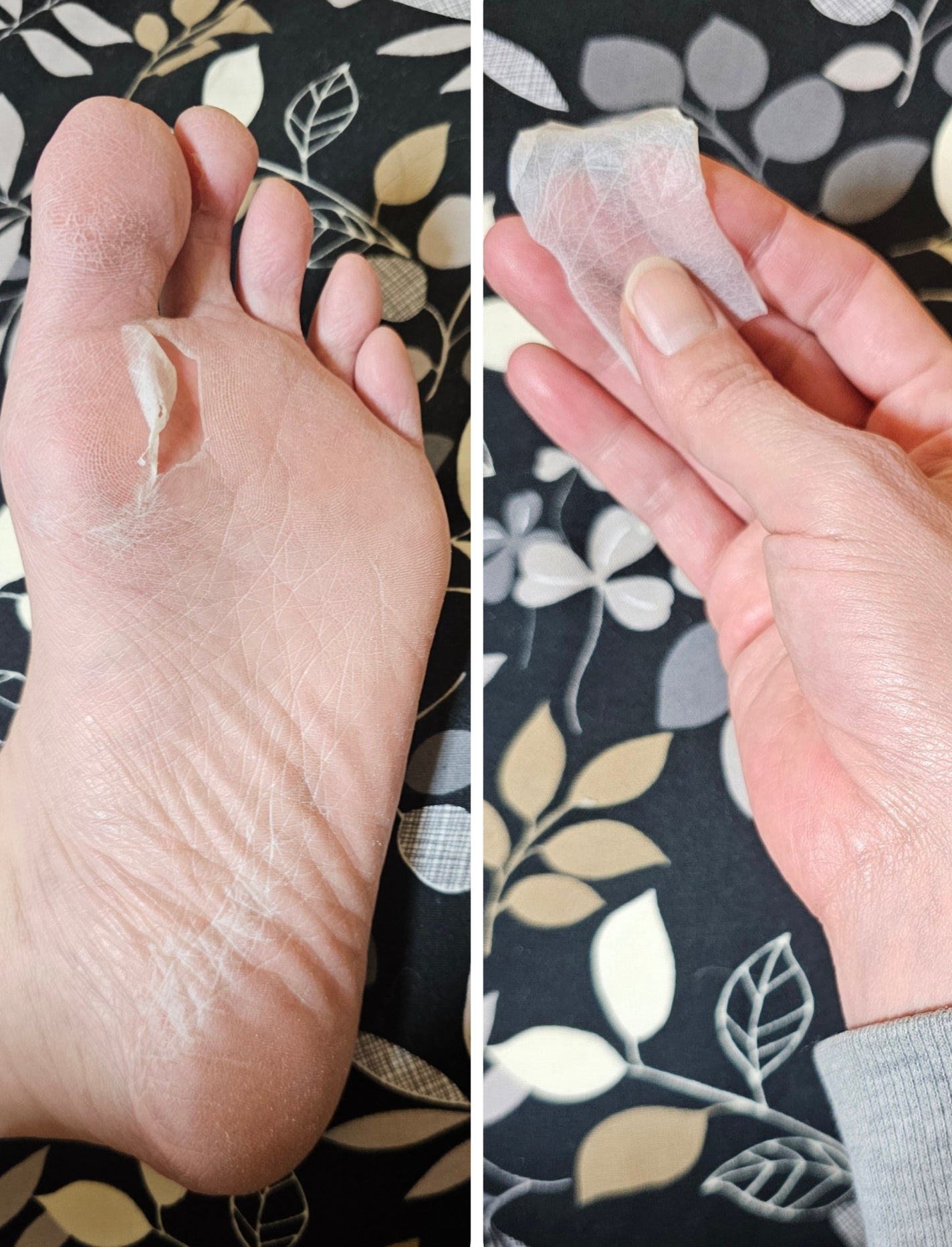 シルキースムーズフットピーリングマスク/MADFORCOS/レッグ・フットケアを使ったクチコミ(5枚目)