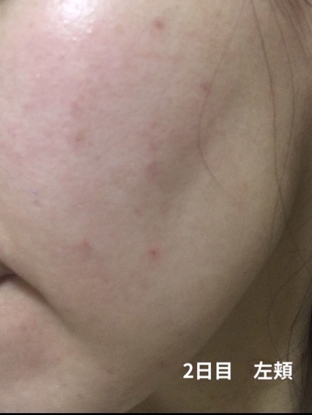 デイリーPD/ZO Skin Health/フェイスクリームを使ったクチコミ（3枚目）