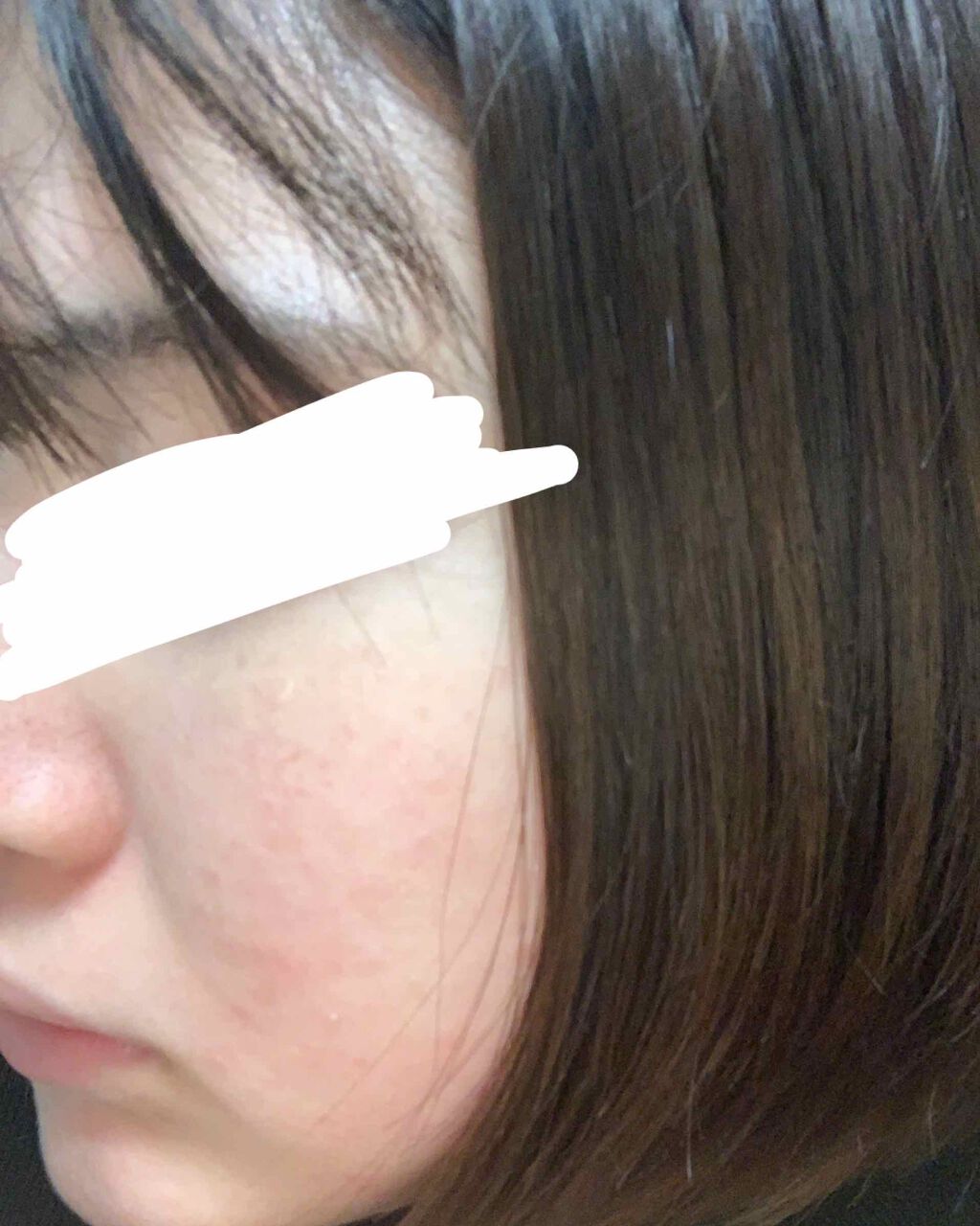 明色美顔水 薬用化粧水/美顔/化粧水を使ったクチコミ（2枚目）