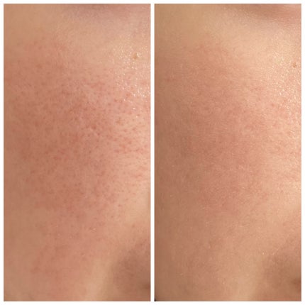 乾燥さん 保湿力スキンケア下地 カバータイプ/乾燥さん/化粧下地を使ったクチコミ(6枚目)