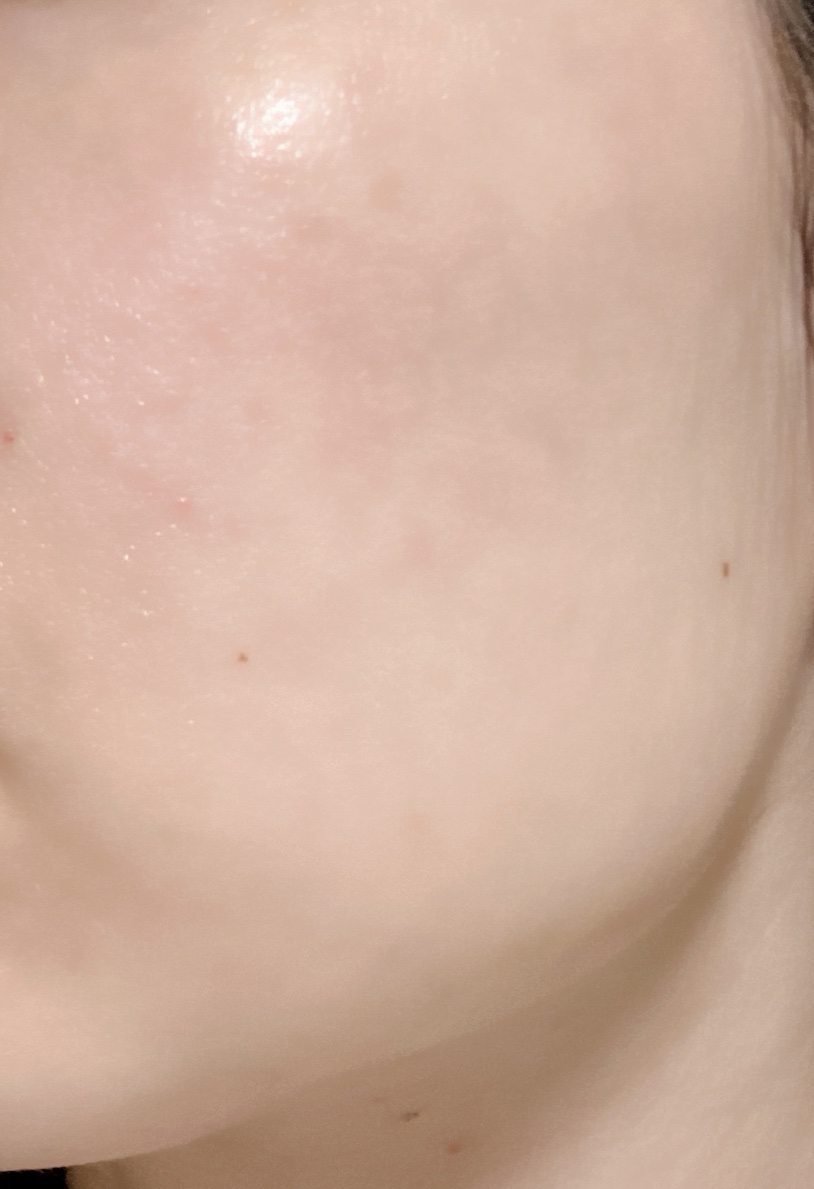 目ざまシート 完熟果実の高保湿タイプ/サボリーノ/シートマスク・パックを使ったクチコミ（1枚目）