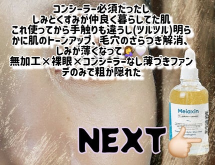 TX-アンプルクレンザー/Dr.Melaxin/美容液を使ったクチコミ(2枚目)