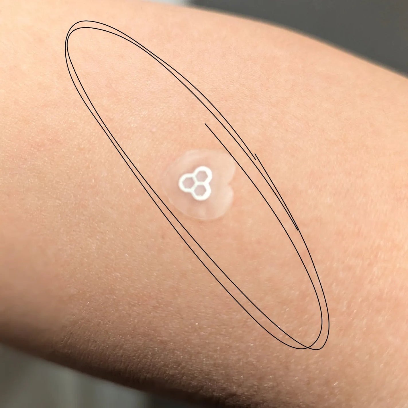 ACマグネシウムパッチ ミニ/スノーツープラス/にきびパッチを使ったクチコミ(4枚目)