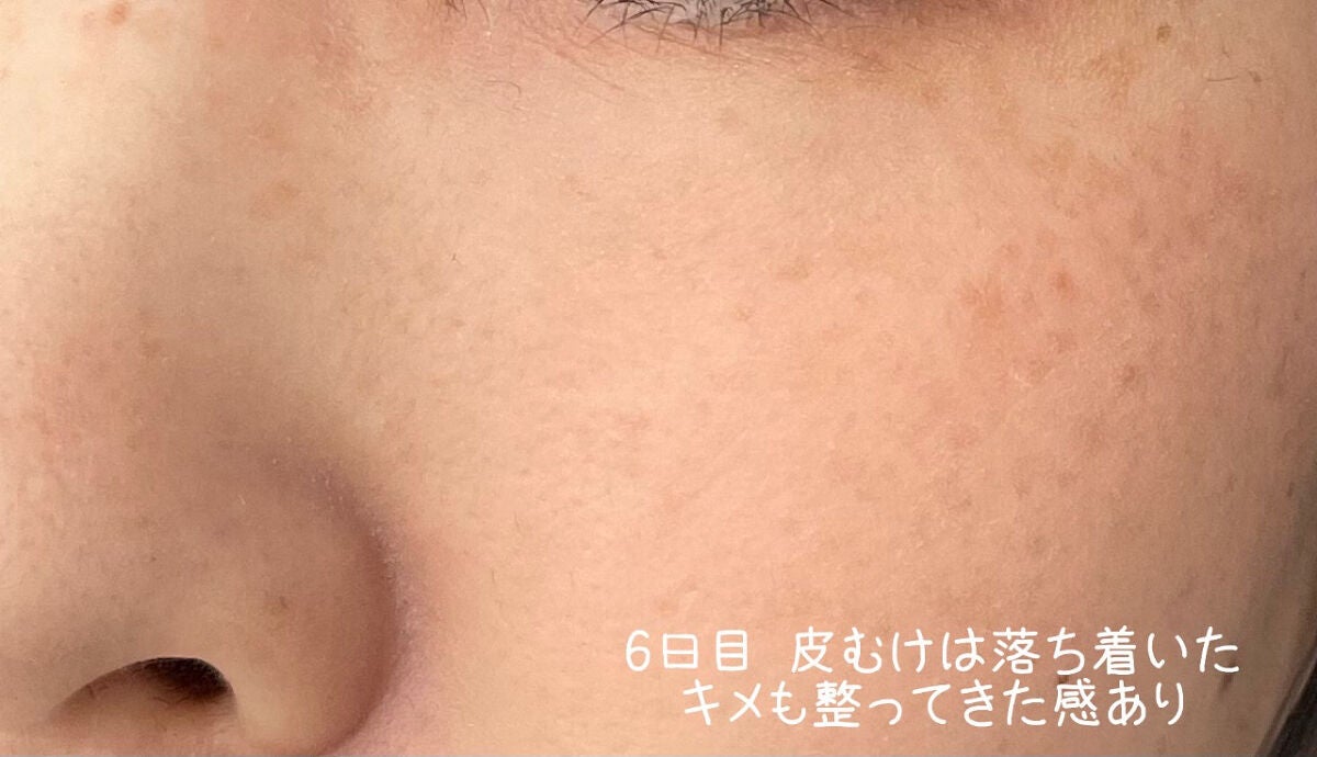 RXザ・レチノール0.1クリーム/COSRX/フェイスクリームを使ったクチコミ(3枚目)