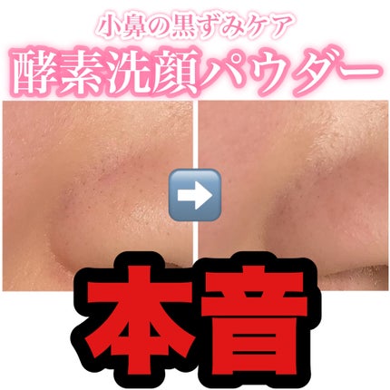 酵素洗顔パウダー トライアル10包/ドットバスター/洗顔パウダーを使ったクチコミ(1枚目)