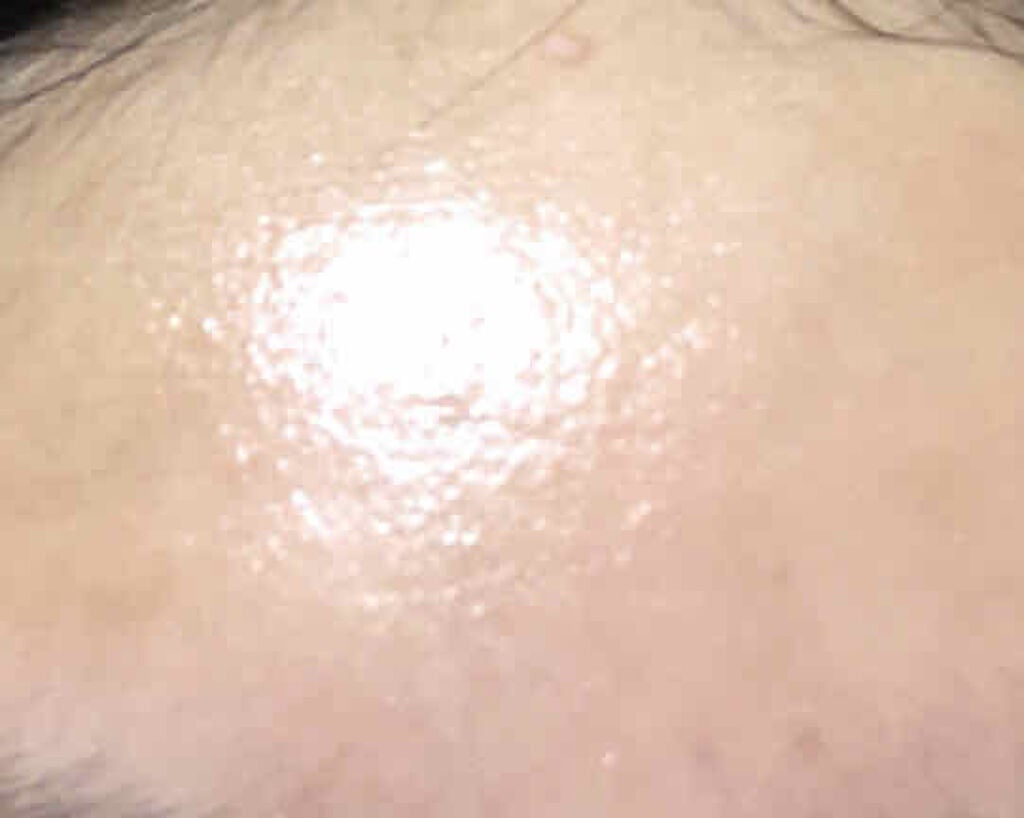 ごまり on LIPS 「こんにちは🥺思春期真っ只中のjc3です^^1.2枚目は肌荒れ時..」(4枚目)