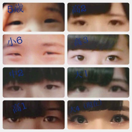 両面二重テープ/DAISO/二重まぶた用アイテムを使ったクチコミ(2枚目)