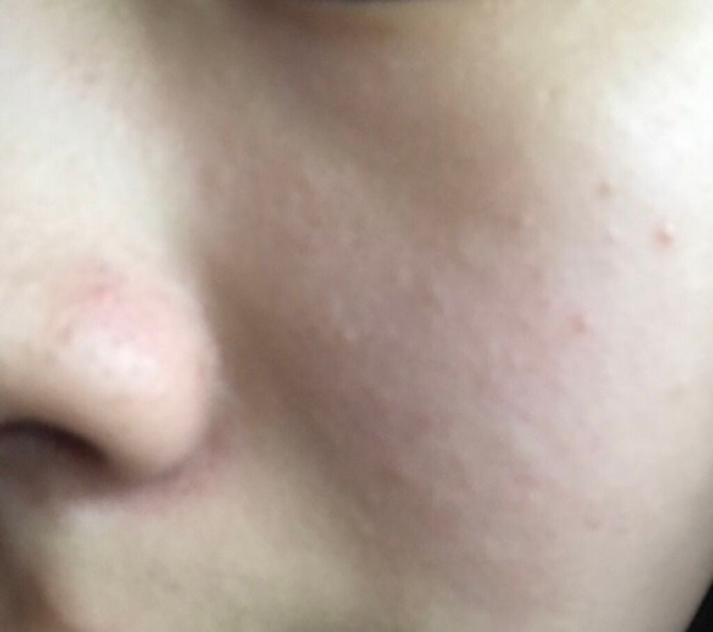 ひな on LIPS 「この肌を綺麗にする方法ありませんか#第一印象UP作戦#はじめて..」(1枚目)