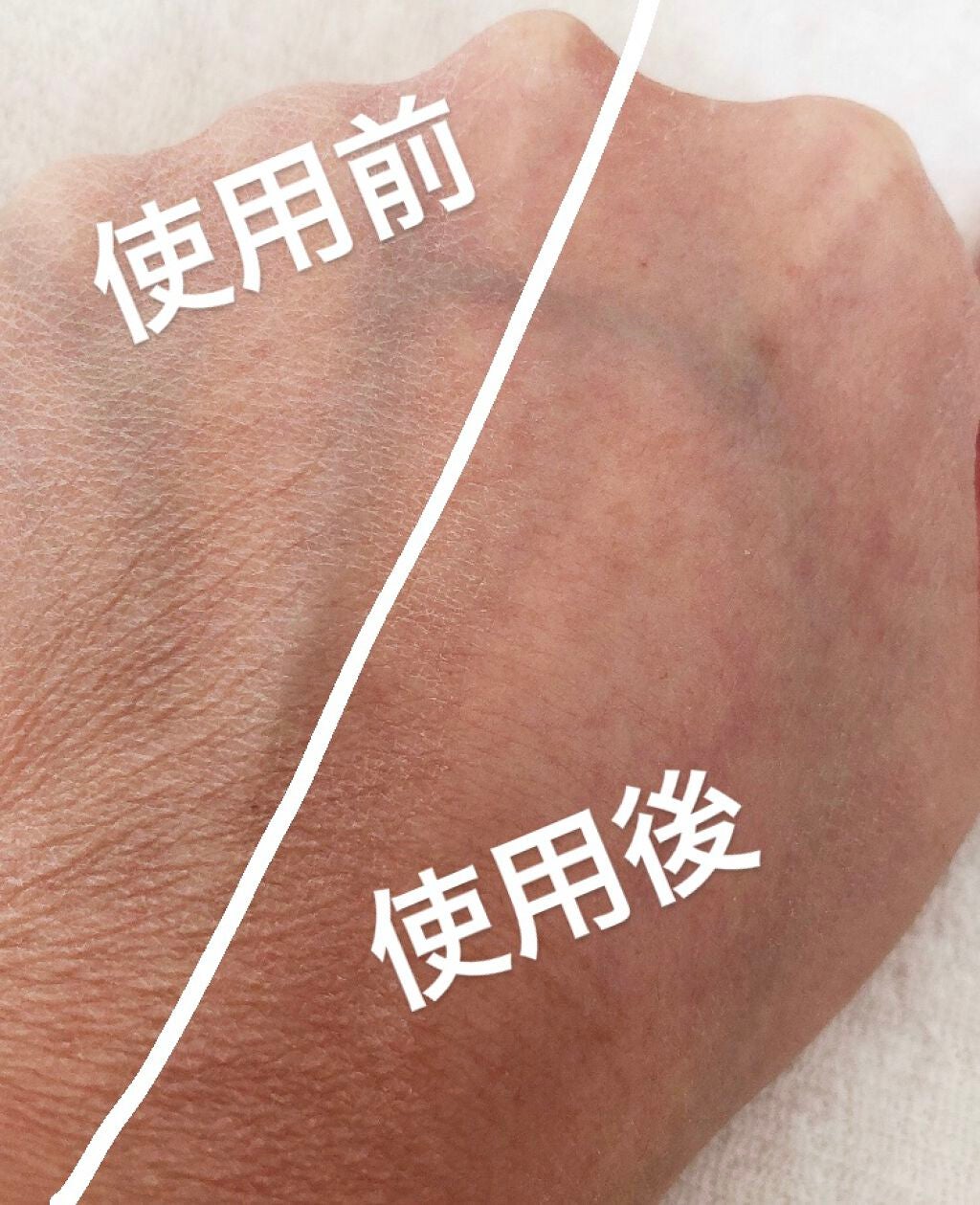 ディープモイスチュアエッセンス/ライスフォース/美容液を使ったクチコミ(5枚目)