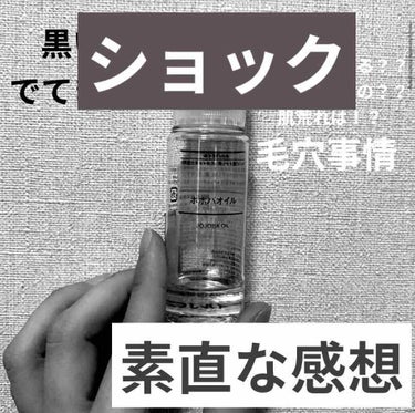 前紹介したホホバオイルで起こったこと...
なんと私は毛穴が綺麗になる前にニキビ大量発生と痒みと荒れが出てしまいもう使ってません、、、

合ってないだけと思ってたんですがもし使い方が違ってたら教えてくだ