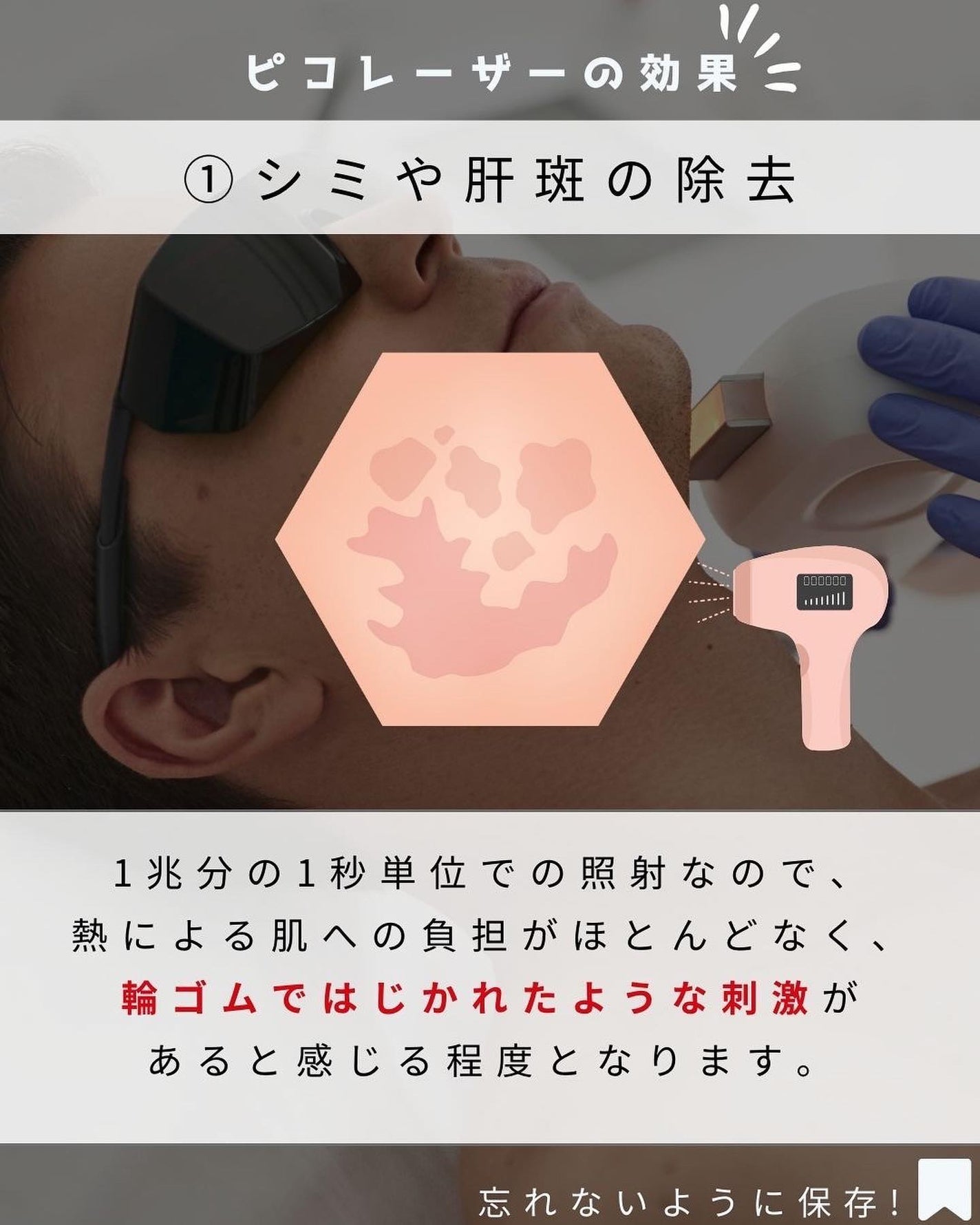 ヨウ | 31歳の老けない暮らし on LIPS 「今回はピコレーザーについてご紹介します!ピコレーザーは、シミ・..」(4枚目)