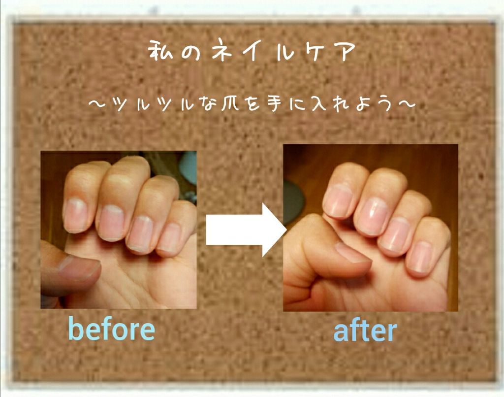 5セカンズシャイン 爪磨き/5セカンズシャイン/ネイル用品を使ったクチコミ（1枚目）