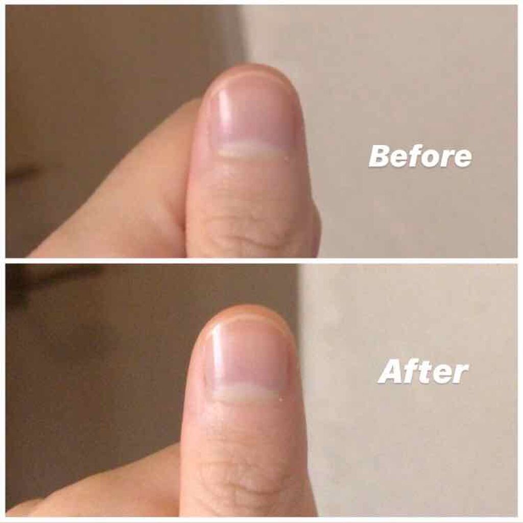 エテュセ クイックケアコート/ettusais/ネイルオイル・トリートメントを使ったクチコミ（2枚目）