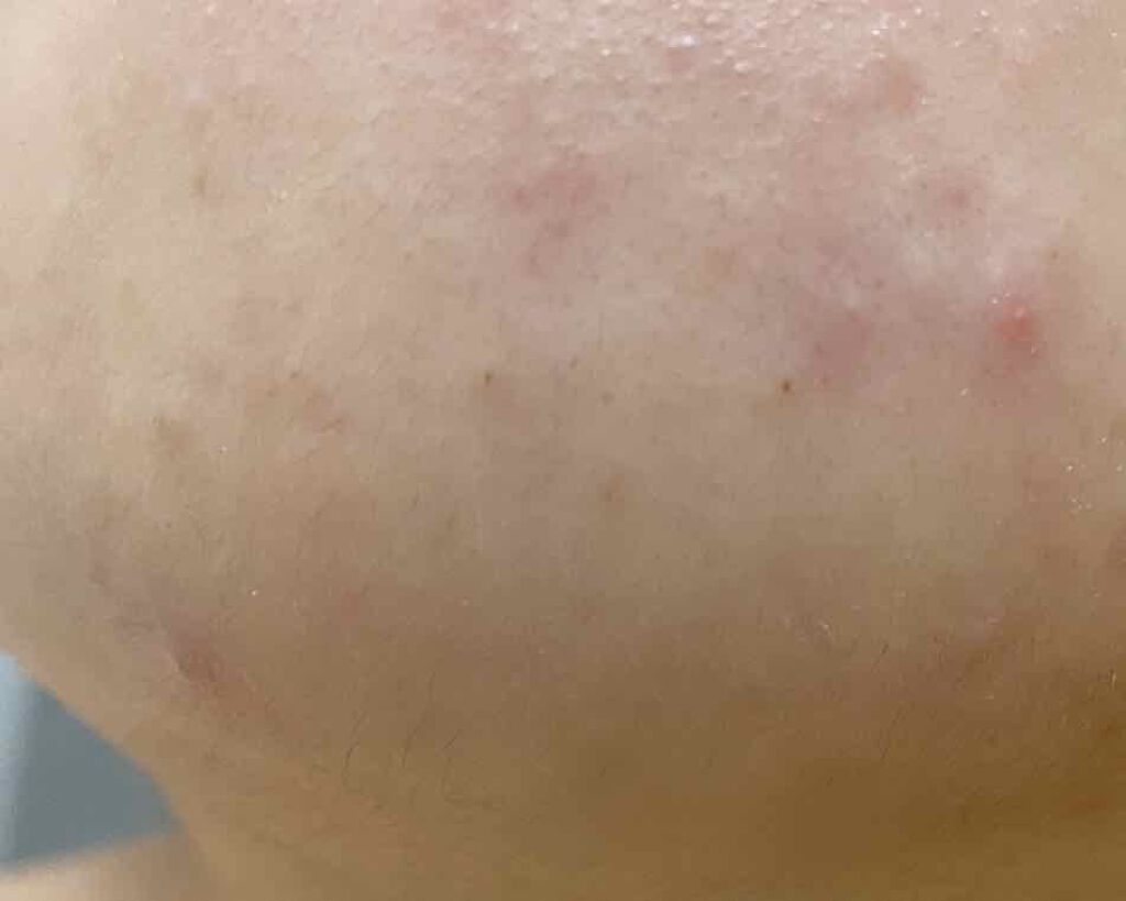 敏感肌用薬用美白美容液/無印良品/美容液を使ったクチコミ(3枚目)