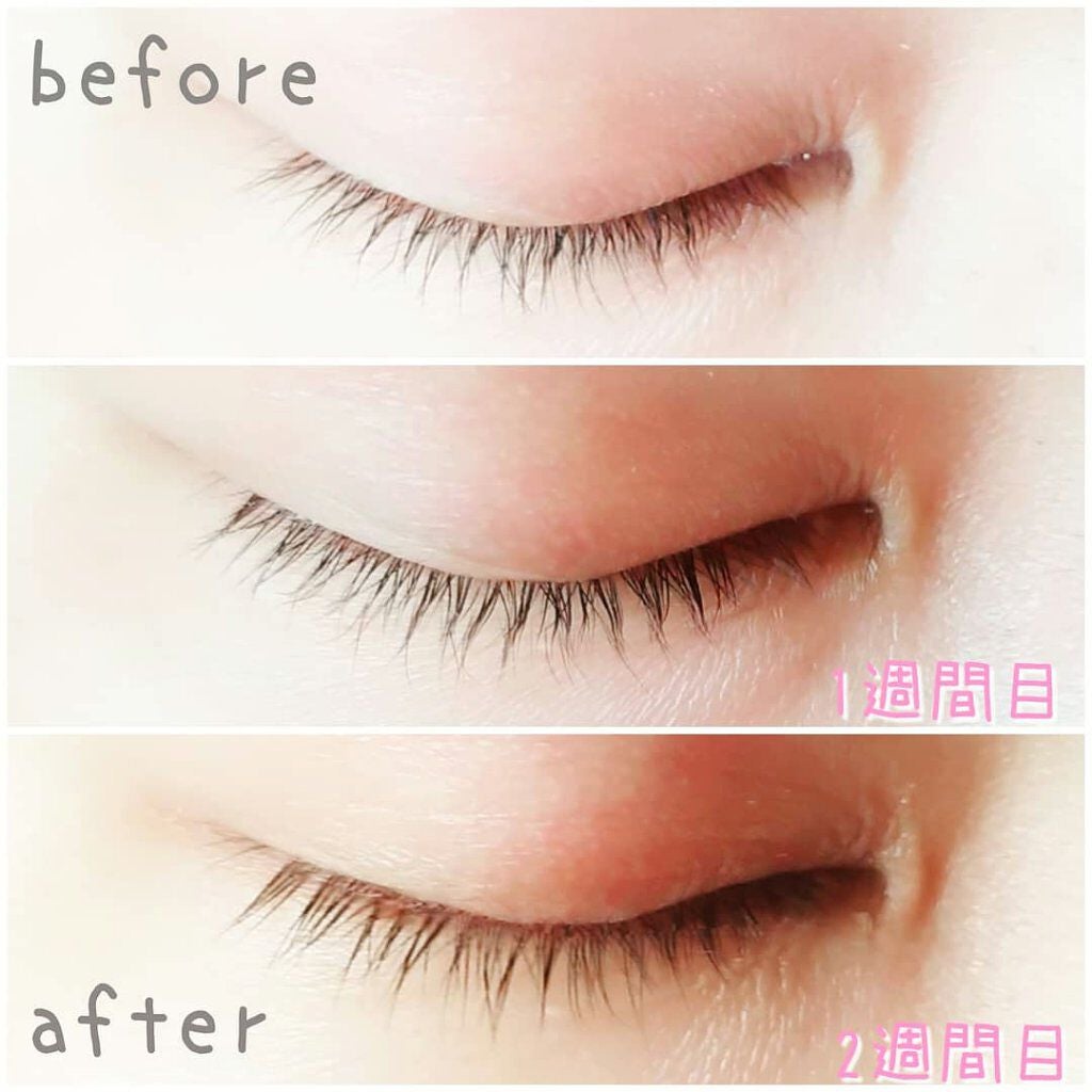 スカルプD ボーテ ピュアフリーアイラッシュセラム プレミアム/アンファー(スカルプD)/まつげ美容液を使ったクチコミ(3枚目)